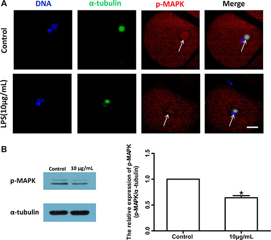 Lipopolysaccharide exposure changed the localization and protein level of p-MAPK in bovine oocytes.