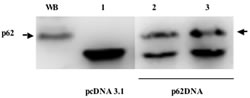 Figure2: Appearance of p62 antibodies in mice serum after immunization with p62 vaccine.