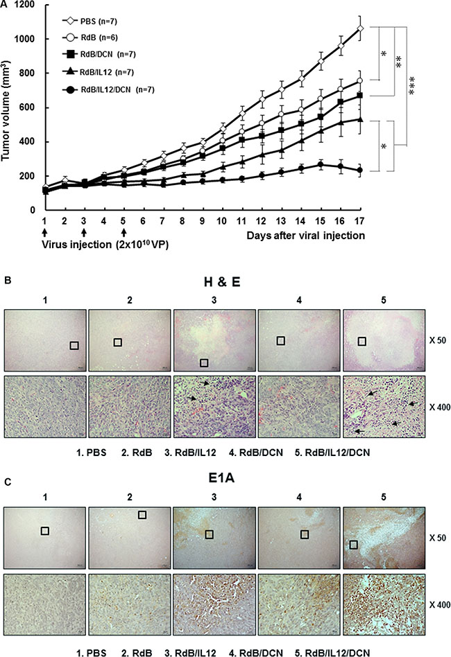 Antitumor effect of oncolytic Ads in an orthotopic breast cancer model.