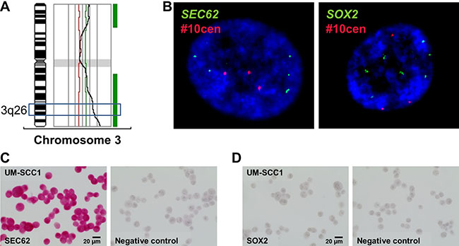 Analysis of copy number variations and expression level of SEC62 and SOX2 in UM-SCC1 cells.