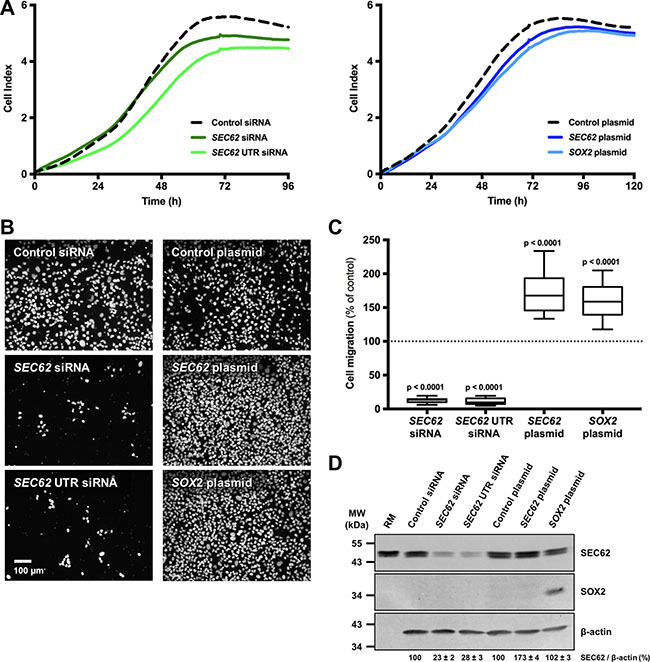 Effect of SEC62 and SOX2 expression on the proliferation and migration of UM-SCC1 cells.