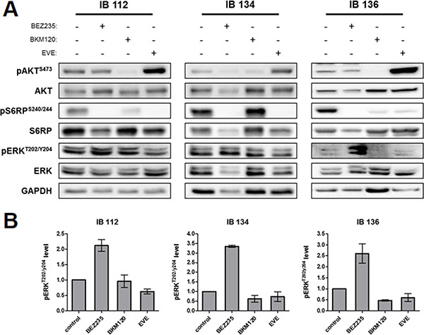 Downstream kinase inhibition by BEZ235, BKM120 and everolimus (EVE) in LMS cell lines.