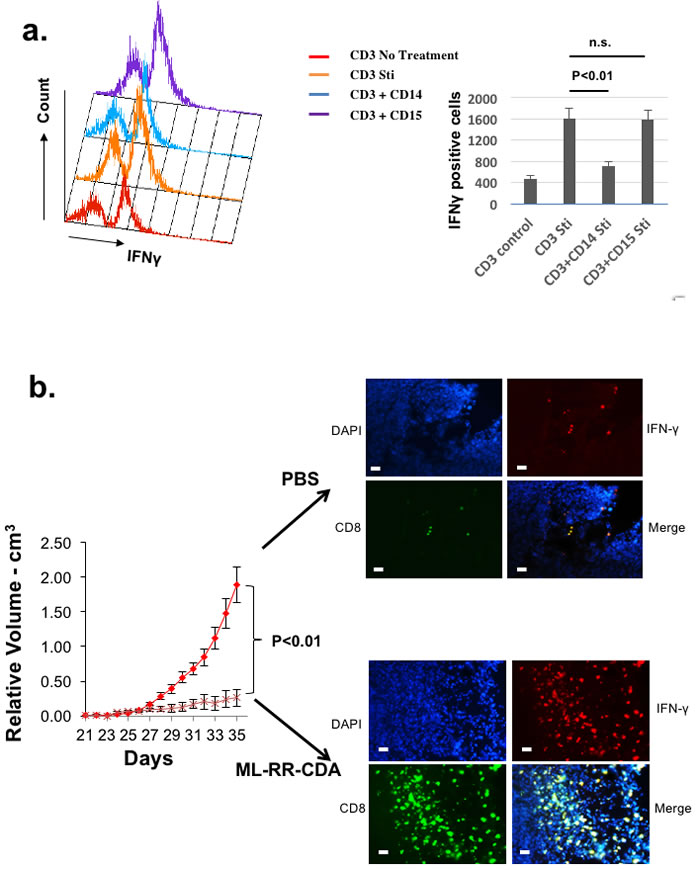 Autologously reconstituted HNSCC tumor system can be used to study human myeloid derived suppressor cells as well as novel immunomodulatory agents.