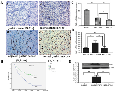 FAF1 is expressed at low levels in gastric cancer tissue, and it predicts poor prognosis.