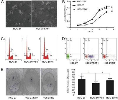 FAF1 overexpression inhibits gastric cancer cell proliferation and induces apoptosis in vitro.