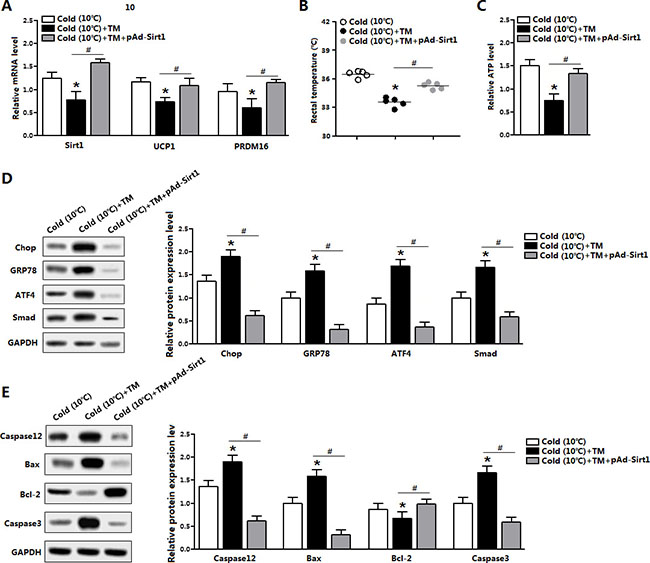 Sirt1 alleviated ER stress-induced cold intolerance in mice.