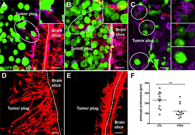 Interaction of tumor cells with brain microenvironment.