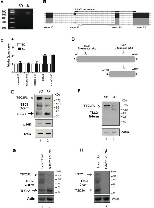 Identification of a novel androgen regulated protein isoform encoded by the tumour suppressor gene