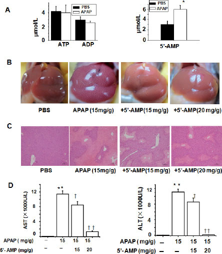 Co-administration of APAP and 5&#x2032;-AMP attenuates APAP-induced hepatotocixity.