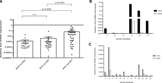 Relative livin mRNA expression levels by quantitative real time RT-PCR analysis.