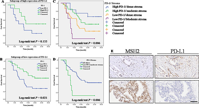 Correlations of MMR gene expression, stroma density and PD-1/PD-L1 expression in PC tissues.