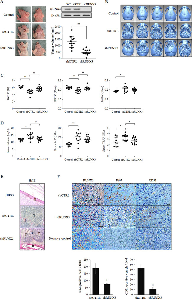 The oncogenic potential of RUNX3 in cancer-induced bone destruction in vivo.