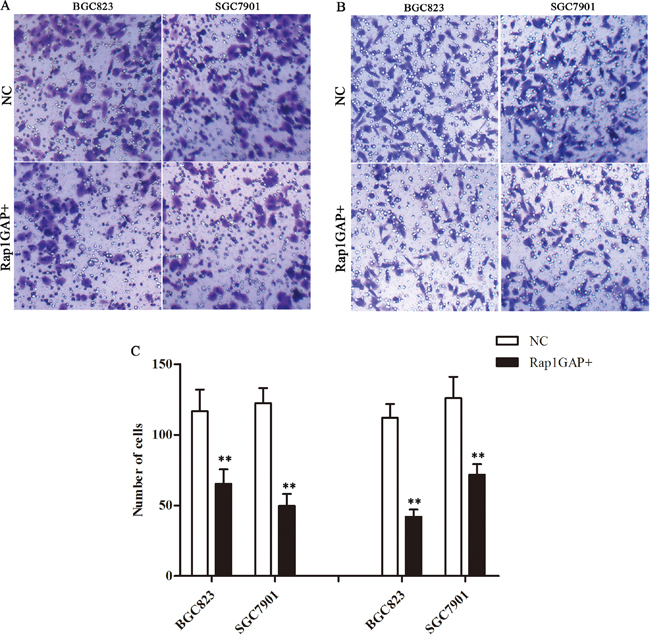 Overexpression Rap1GAP on the regulation of the migration and invasion capacity of tumor cells.