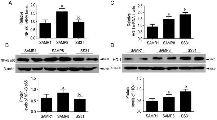 The levels of NF-&#x3ba;B p65 and HO-1 were different between SAMR1 and SAMP8, While SS31 exerted anti-inflammatory effects.