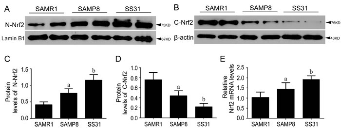 Nrf2-ARE pathway was activated in SAMP8 relative to SAMR1 and exerted anti-oxidant effects after administration of SS31.