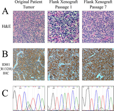Characteristic histological and genetic features of the IDH1 (R132H) anaplastic astrocytoma model.