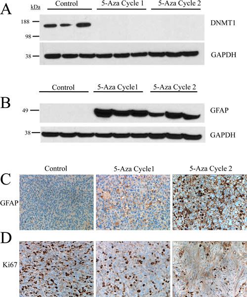 Treatment with 5-azacytidine induces differentiation and reduces the proliferative index in an