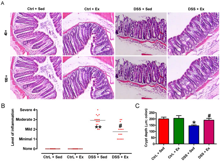 Swimming attenuates DSS-induced histopathological damage in the rat colon.