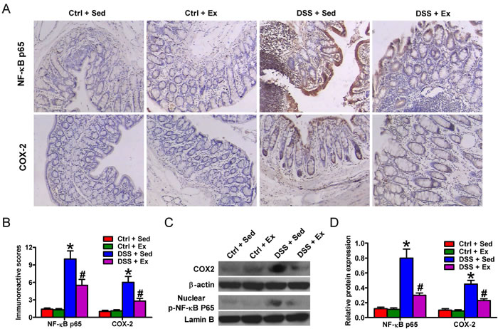 Swimming decreases the expression of NF-&#x3ba;B p65 and COX2 protein in the colon of rats with DSS-induced colitis.