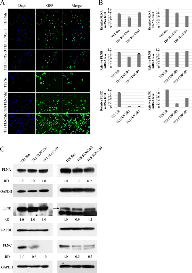 shRNA of FLNC specifically inhibits FLNC expression in shRNA infected ESCC cell lines.