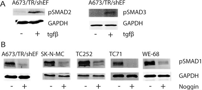Phosphorylation status of SMADs upon TGFB or Noggin treatment.