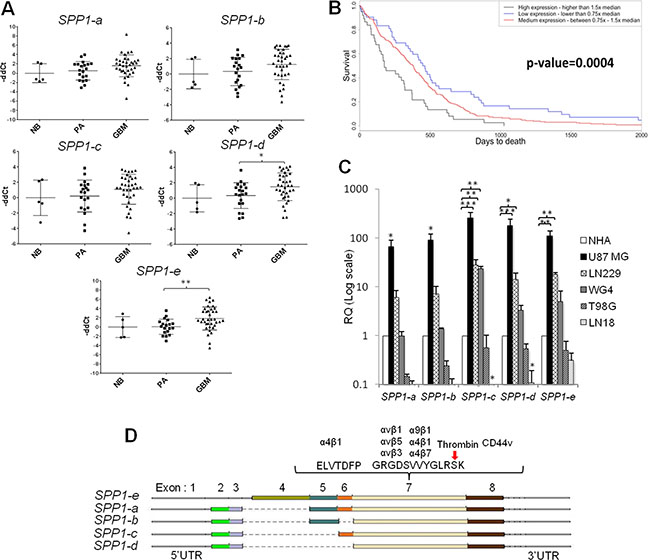 The expression pattern of SPP1 splicing variants in glioma clinical samples and human glioma cell lines.