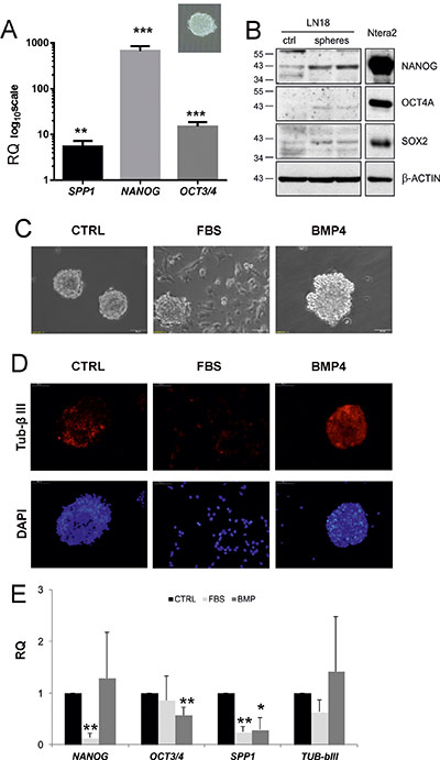 SPP1 expression is up-regulated in glioma spheres and reduced after forced differentiation.