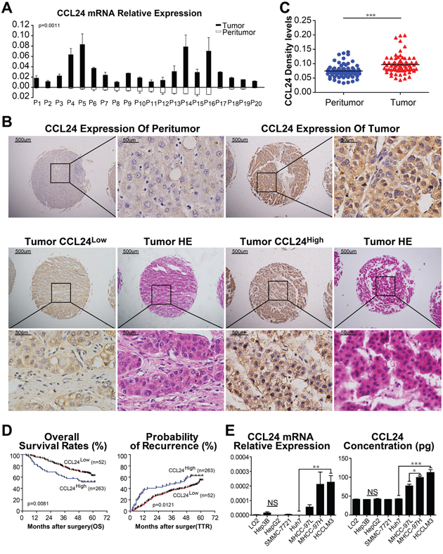 CCL24 expression in HCC tissues and HCC cell lines.