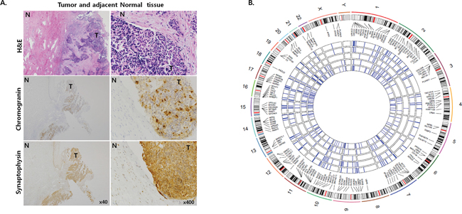 Representative histopathological analyses and somatic mutation signatures from five CSCNETs.