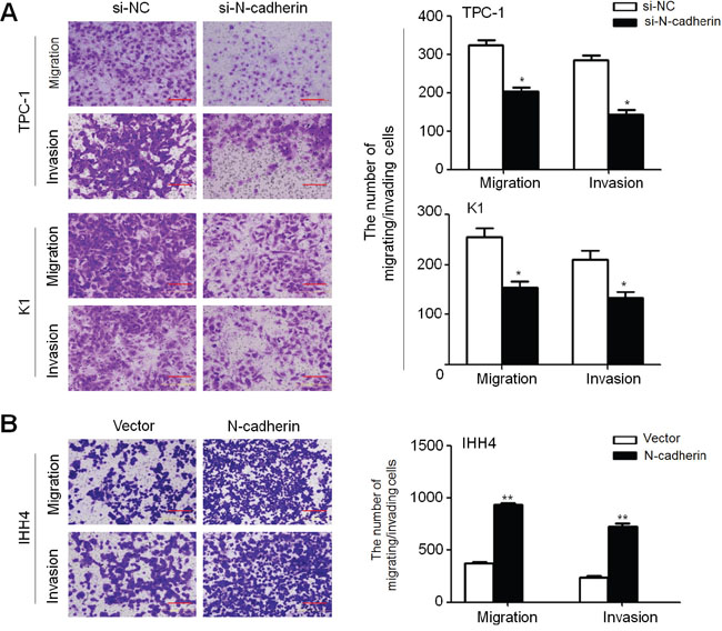 Increased cell migration and invasion in thyroid cancer cells by N-cadherin.