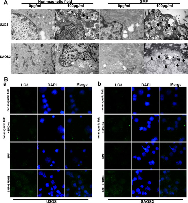 SPIONs induce apoptosis, mitochondria impair and autophagy in osteosarcoma cell lines.
