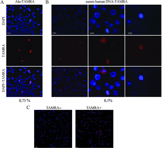 Analysis of internalization of a TAMRA-labeled DNA into the Krebs-2 cells (Axioskop 2 Plus, Zeiss).