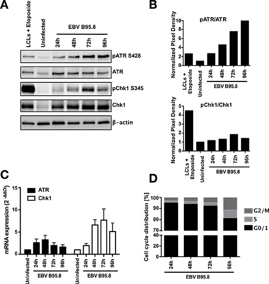 EBV inoculation elicits ATR/Chk1-mediated DDR activation in tonsillar B-cells (TBCs).