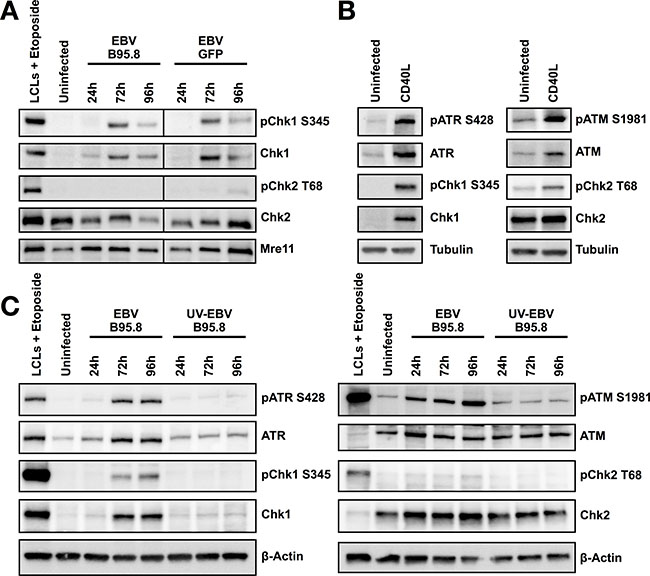 Hyperproliferation of CD19+ TBCs induced by CD40L activates Chk1 but not inoculation with UV inactivated EBV-B95.8 activates Chk1.