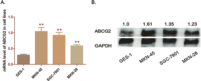 Expression of ABCG2 in GC cell lines.