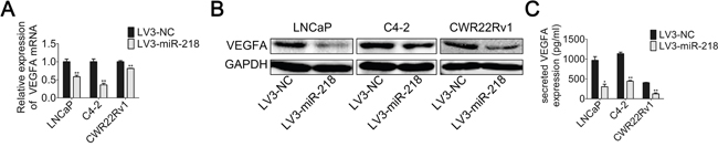 miR-218 inhibits VEGFA expression.