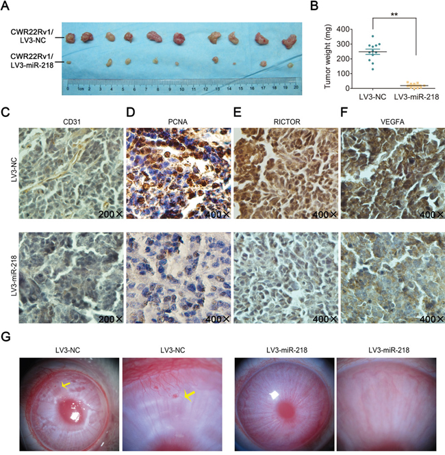 miR-218 inhibits tumor growth and angiogenesis in vivo.