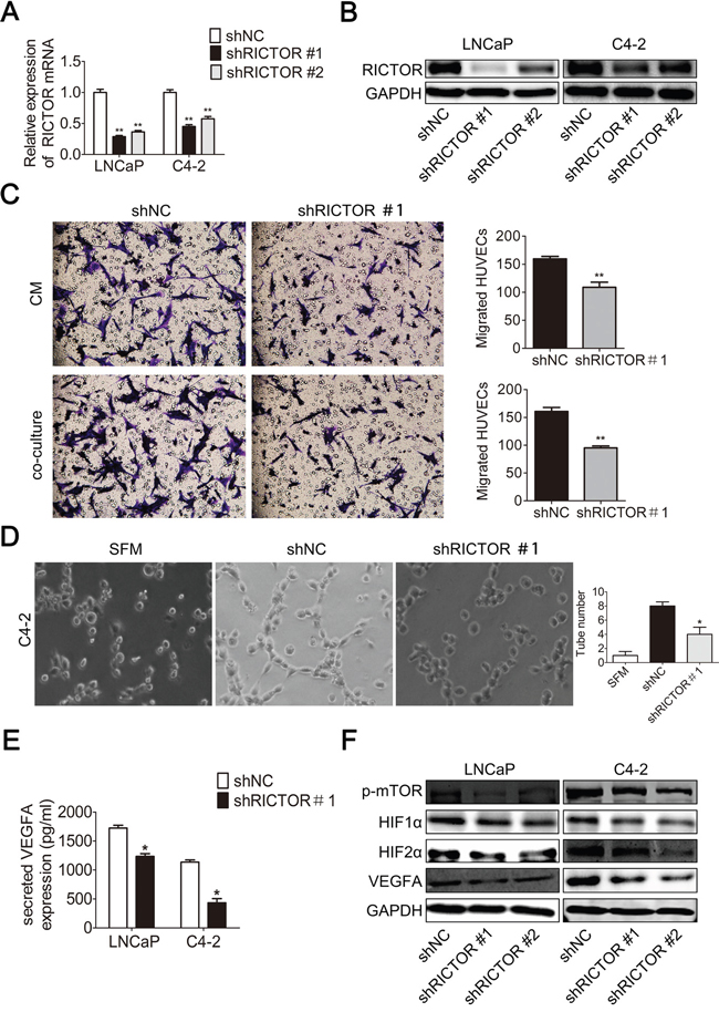 RICTOR knockdown reduces angiogenesis in prostate cancer cells.
