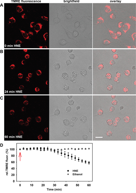 Alteration of the mitochondrial membrane potential and cellular morphology after addition of 4-hydroxy- 2-nonenal (HNE) to N18TG2 neuroblastoma cells in a typical experiment.