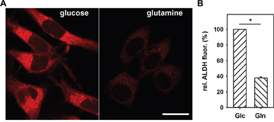 Nutrient dependence of AldeRed fluorescence in N18TG2 cells.