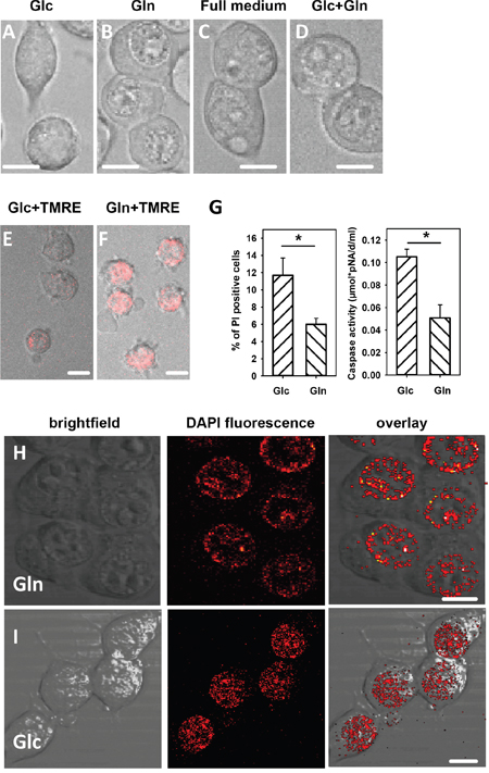 Morphology, viability and nucleus morphology of cells incubated in different media after addition of HNE observed with brightfield and fluorescent microscopy.