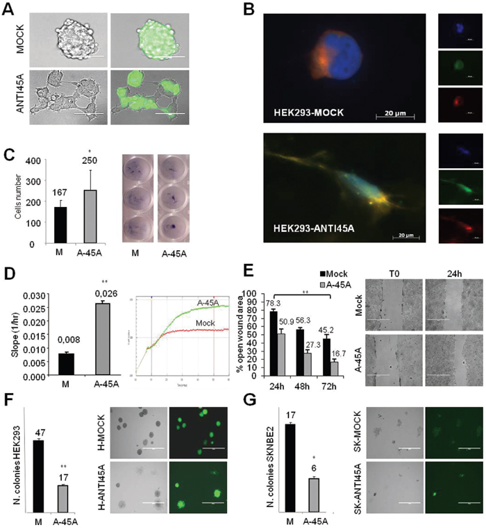 Cell morphology and migration potential after inhibition of 45A ncRNA.