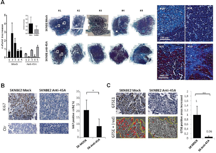 45A ncRNA down-regulation increased tumor nodule compactness and collagen fibers organization.