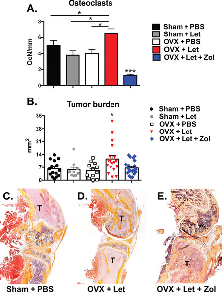 Histological assessment of tumor-bearing bone of estrogen deficient nude mice.