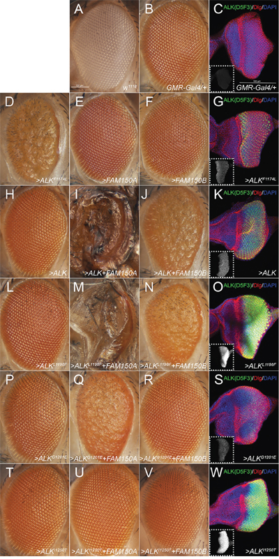 Effects of the ectopic expression of human ALK variants in the Drosophila eye.