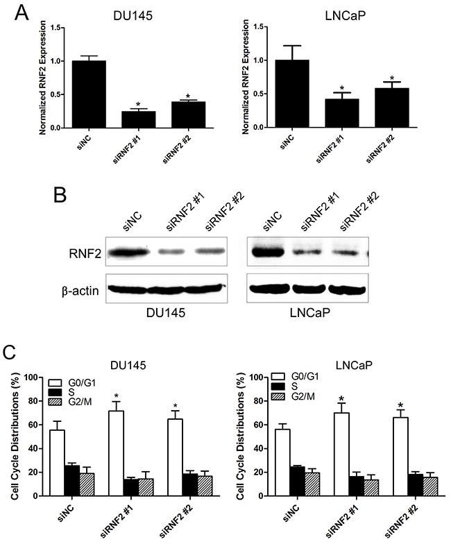Knockdown of RNF2 resulted in cell cycle arrest and apoptosis in DU145 and LNCaP cells.
