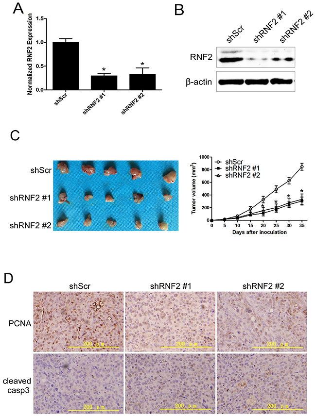 Knockdown of RNF2 inhibited the growth of PCa xenograft in nude mice.