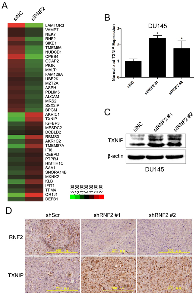 TXNIP expression was increased in RNF2 knockdown DU145 cells.