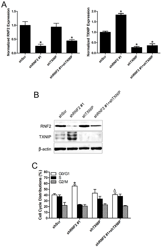 Simultaneously knockdown of TXNIP can partially rescue the phenotype in RNF2 single knockdown DU145 cells.