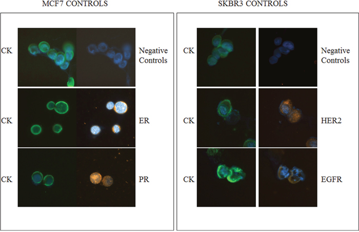 ER, PR, HER2 and EGFR expression in breast cancer cell lines.